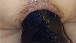 Расширитель ануса - порно видео
